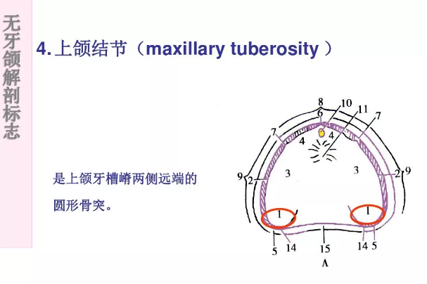 全口義齒解剖標誌 - 精品牙齒